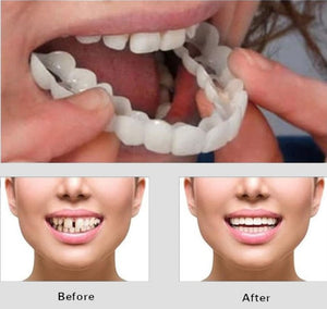 CARILLAS DENTALES