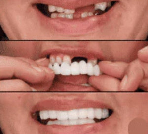 CARILLAS DENTALES