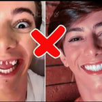 CARILLAS DENTALES