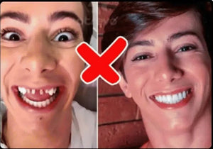 CARILLAS DENTALES
