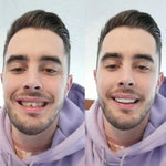 CARILLAS DENTALES